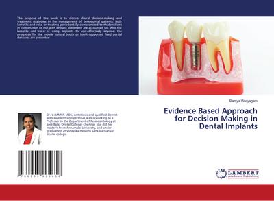 Evidence Based Approach for Decision Making in Dental Implants