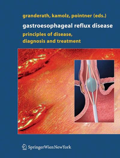 Gastroesophageal Reflux Disease