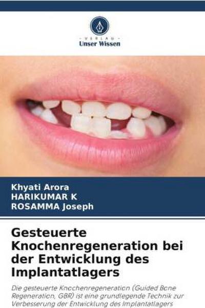 Gesteuerte Knochenregeneration bei der Entwicklung des Implantatlagers