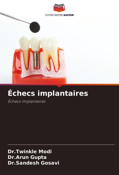 Échecs implantaires