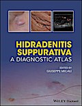 Hidradenitis Suppurativa