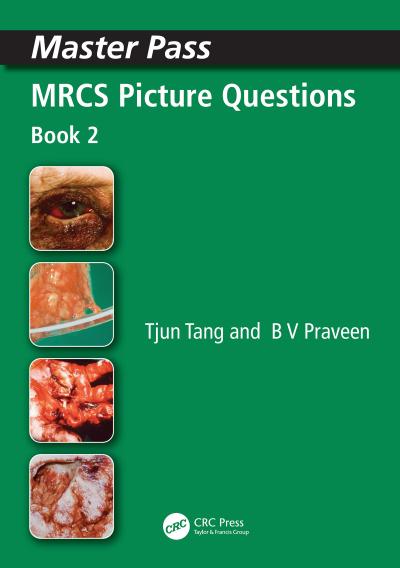 MRCS Picture Questions