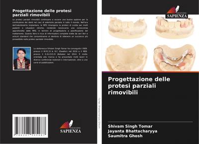 Progettazione delle protesi parziali rimovibili