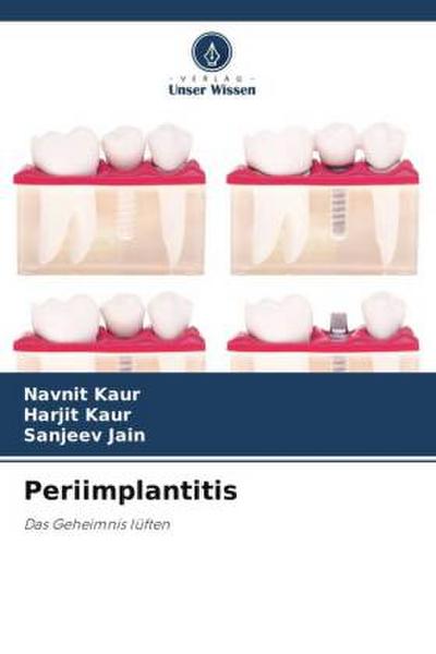 Periimplantitis