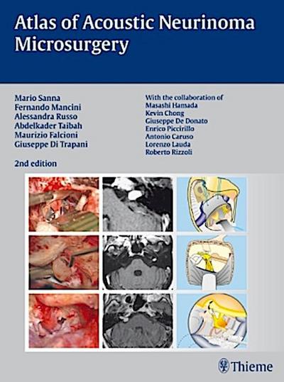 Atlas of Acoustic Neurinoma Microsurgery