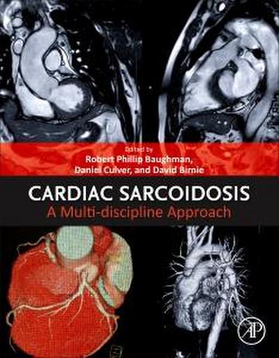 Cardiac Sarcoidosis