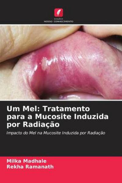 Um Mel: Tratamento para a Mucosite Induzida por Radiação