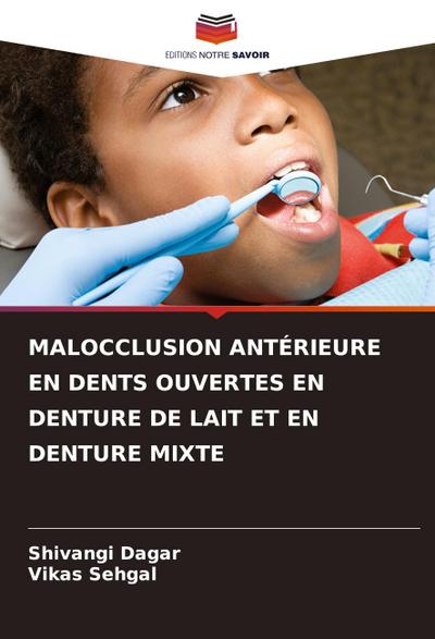 MALOCCLUSION ANTÉRIEURE EN DENTS OUVERTES EN DENTURE DE LAIT ET EN DENTURE MIXTE