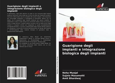 Guarigione degli impianti e integrazione biologica degli impianti