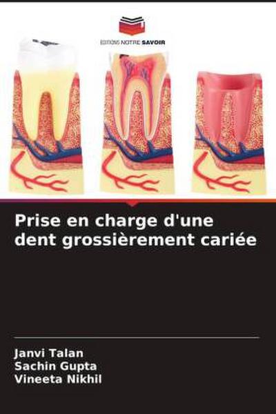 Prise en charge d’une dent grossièrement cariée