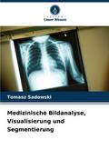 Medizinische Bildanalyse, Visualisierung und Segmentierung