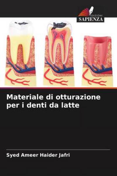 Materiale di otturazione per i denti da latte
