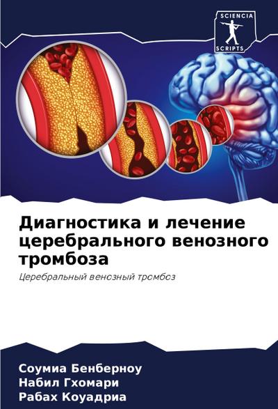 Diagnostika i lechenie cerebral’nogo wenoznogo tromboza