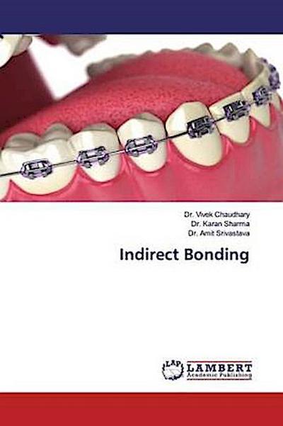 Indirect Bonding