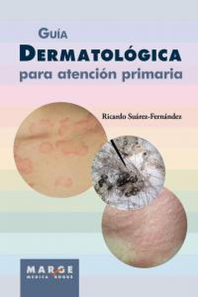 Guía dermatológica para atención primaria