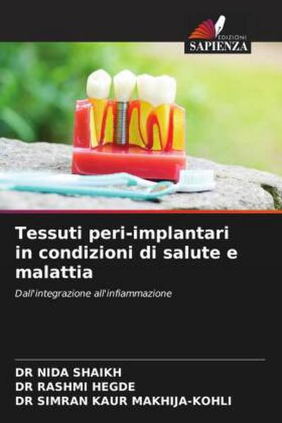 Tessuti peri-implantari in condizioni di salute e malattia