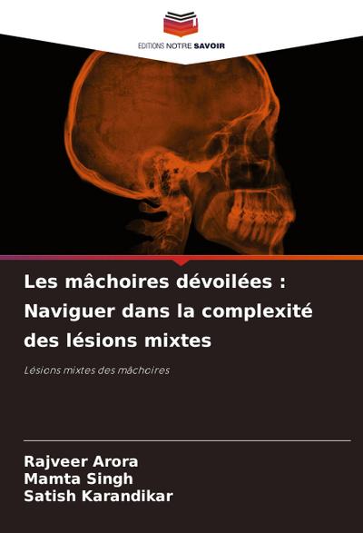 Les mâchoires dévoilées : Naviguer dans la complexité des lésions mixtes