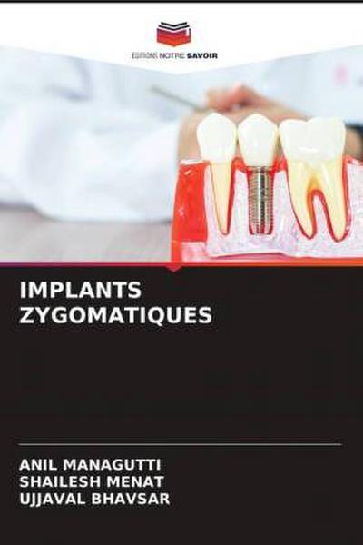 IMPLANTS ZYGOMATIQUES