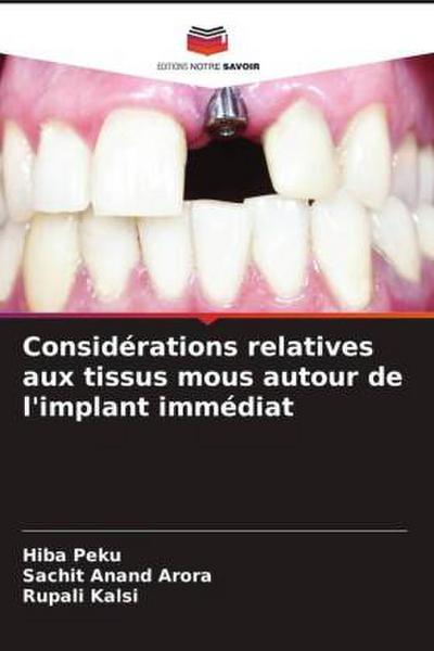 Considérations relatives aux tissus mous autour de l’implant immédiat