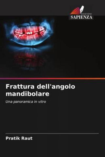 Frattura dell’angolo mandibolare