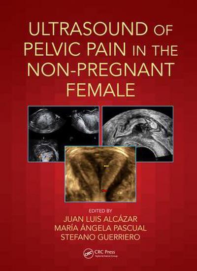 Ultrasound of Pelvic Pain in the Non-Pregnant Patient