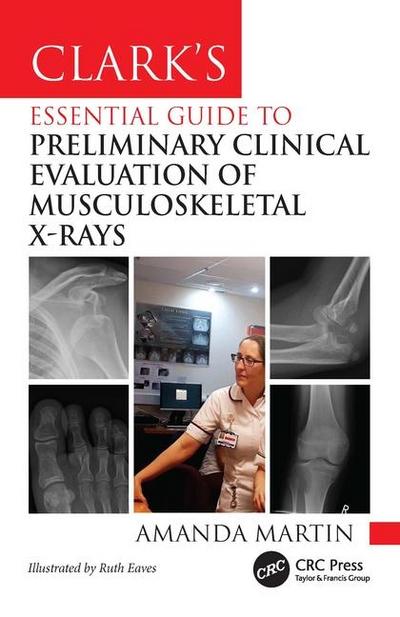 Clark’s Essential Guide to Preliminary Clinical Evaluation of Musculoskeletal X-Rays