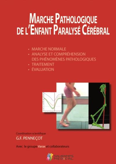 Marche pathologique de l’’enfant paralysé cérébral