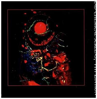 The Zebrafish: Disease Models and Chemical Screens