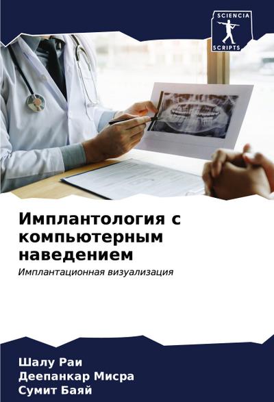 Implantologiq s komp’üternym nawedeniem