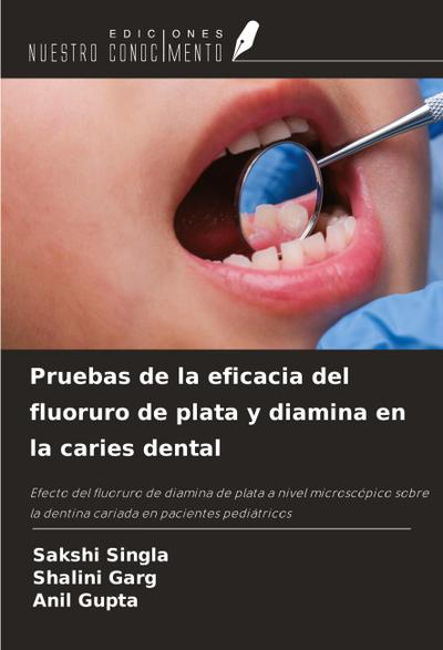 Pruebas de la eficacia del fluoruro de plata y diamina en la caries dental