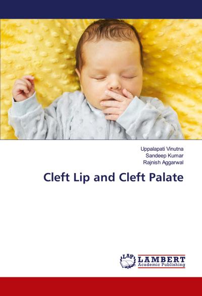 Cleft Lip and Cleft Palate