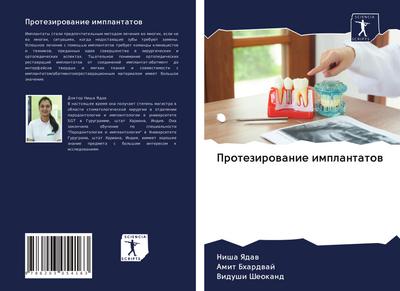 Protezirowanie implantatow