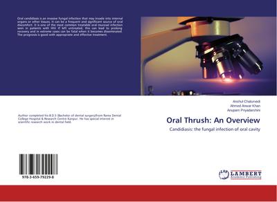 Oral Thrush: An Overview