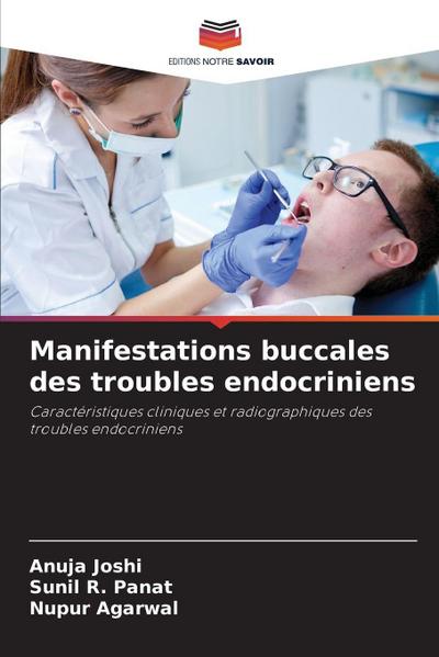 Manifestations buccales des troubles endocriniens