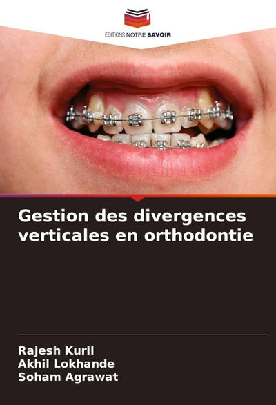 Gestion des divergences verticales en orthodontie
