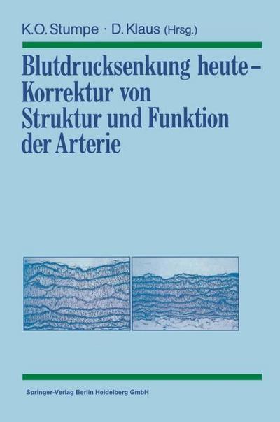 Blutdrucksenkung heute - Korrektur von Struktur und Funktion der Arterie