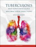 Tuberculosis and Nontuberculous Mycobacterial Infections
