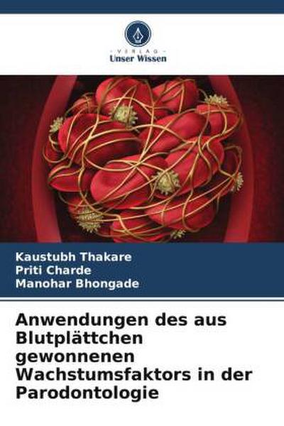 Anwendungen des aus Blutplättchen gewonnenen Wachstumsfaktors in der Parodontologie