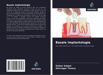 Basale implantologie