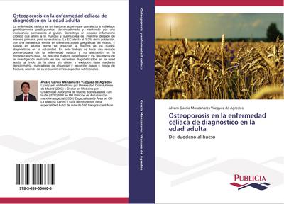 Osteoporosis en la enfermedad celíaca de diagnóstico en la edad adulta