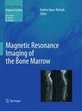 Magnetic Resonance Imaging of the Bone Marrow