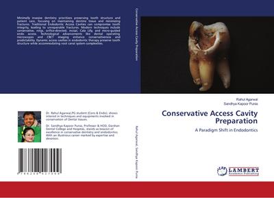 Conservative Access Cavity Preparation
