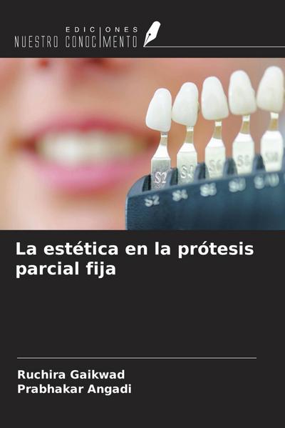 La estética en la prótesis parcial fija