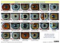 Konstitutionsorientierte Irisdiagnose, Tafel