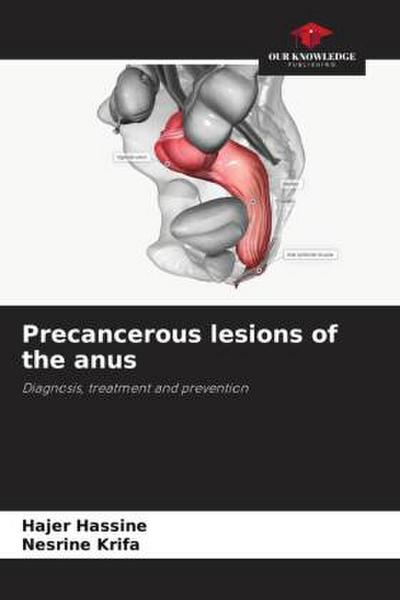 Precancerous lesions of the anus