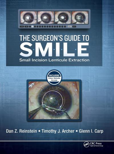 The Surgeon’s Guide to SMILE