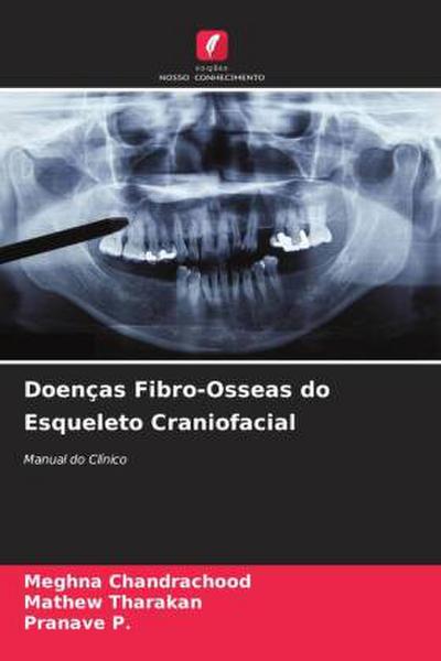 Doenças Fibro-Osseas do Esqueleto Craniofacial