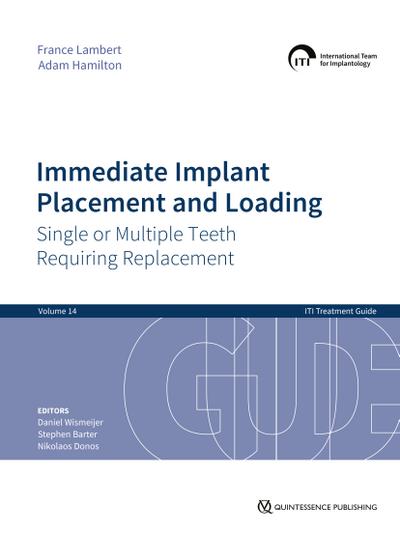 Immediate Implant Placement and Loading – Single or Multiple Teeth Requiring Replacement