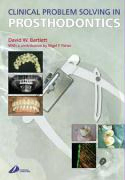 Clinical Problem Solving in Prosthodontics