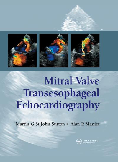 Mitral Valve Transesophageal Echocardiography